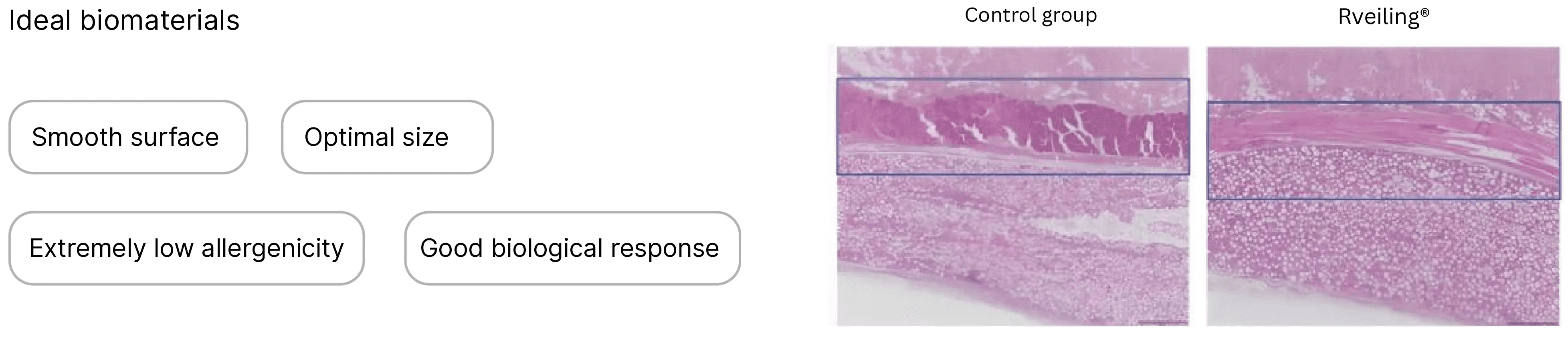 Rveiling® PLLA-PEG Microspheres Appearance: Smooth spherical PLLA-PEG microsphere particles, non-toxic, extremely safe, non-irritating, uniform particle size, and comparative biological response effects upon implantation into soft tissue.