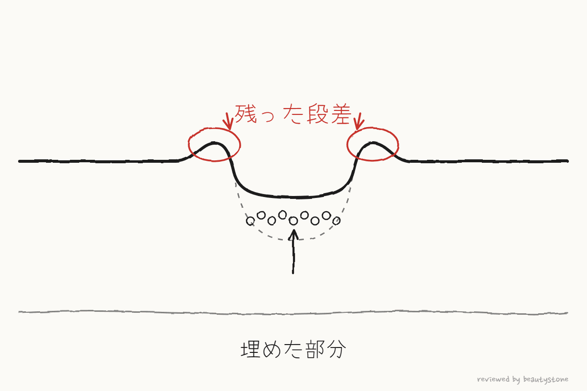 底は埋まったものの、縁に段差が残った断面をペンで描いた図