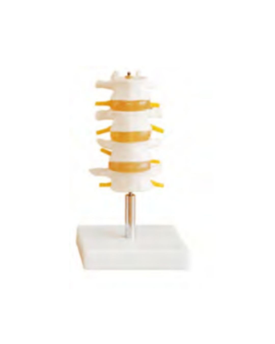 Lumbar Vertebra