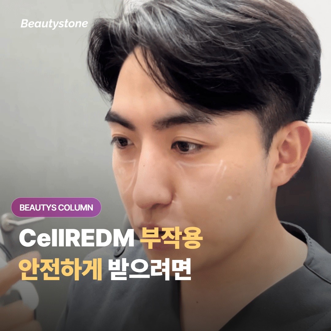 CellREDM 膚質助推器（스킨부스터）有哪些副作用？要如何做才能安全地接受治療？