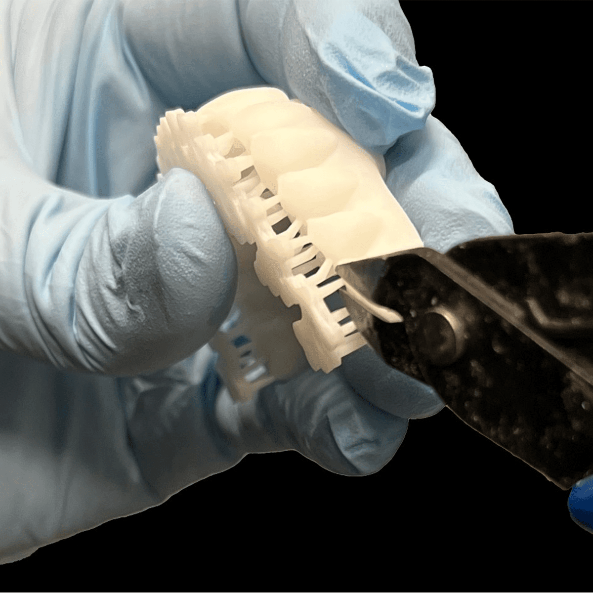 Digital Treatment Planning