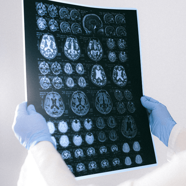 PJsoMvLvr4Ne5fJ2DrIigkxAqak