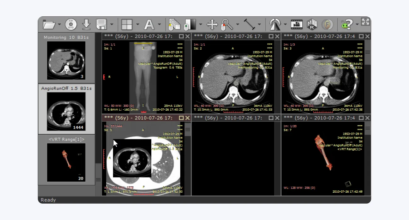 RadiAnt DICOM viewer