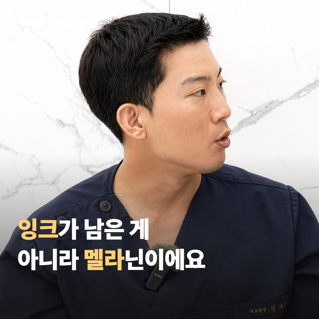 색소 침착은 잉크가 남은 게 아니라 멜라닌이 올라온 거예요