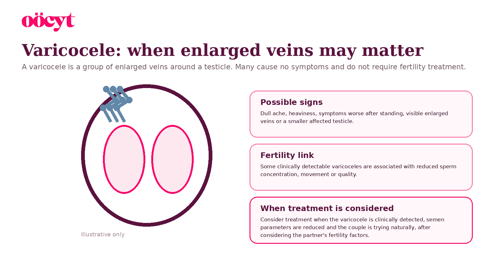 A simplified testicular illustration with enlarged veins and three cards explaining symptoms, fertility links and when treatment may be considered.