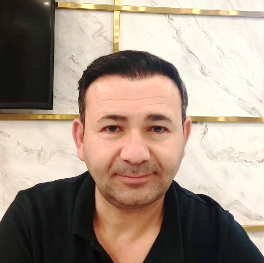 After hair transplant