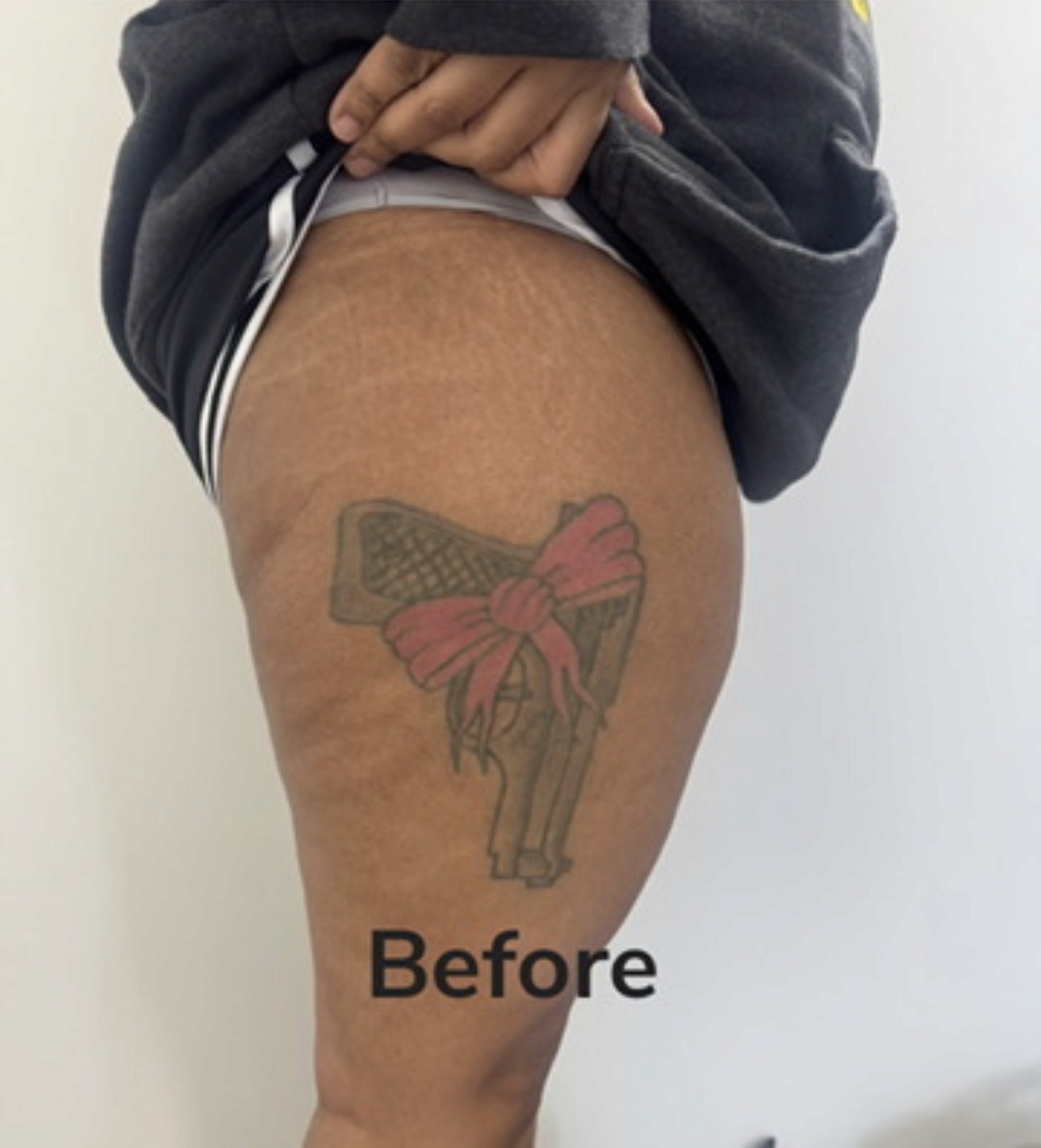 Before: the original tattoo on the thigh before the Floral Cover-Up by Meer Rich
