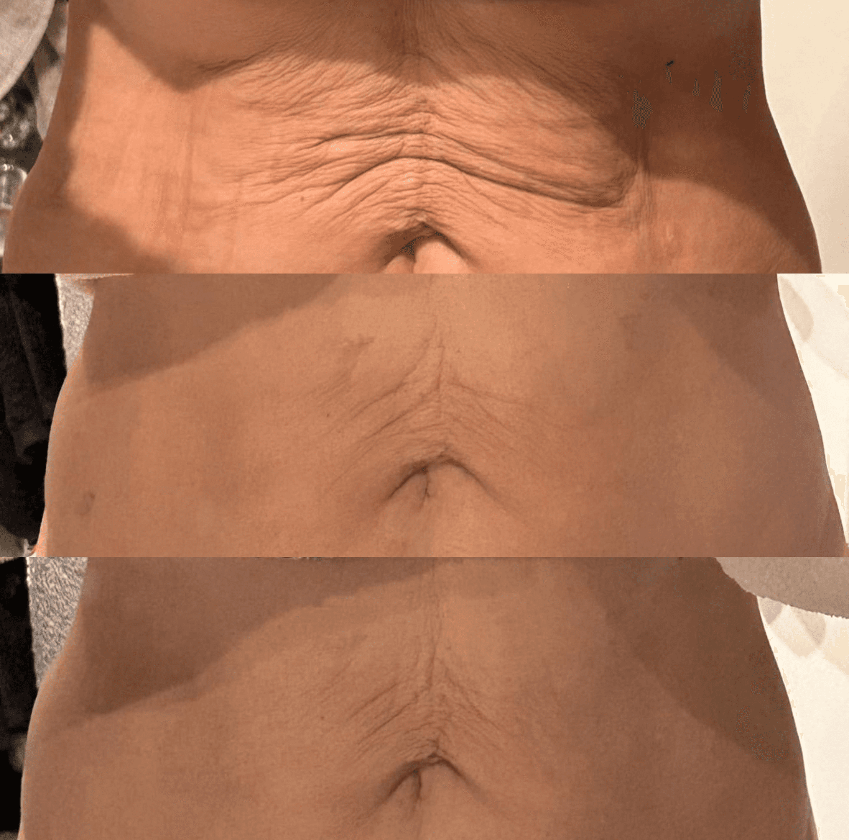 Leszczenko beauty fotodynamika