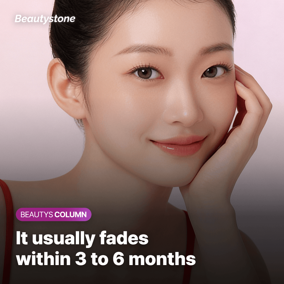 Generally, these marks fade within 3 to 6 months