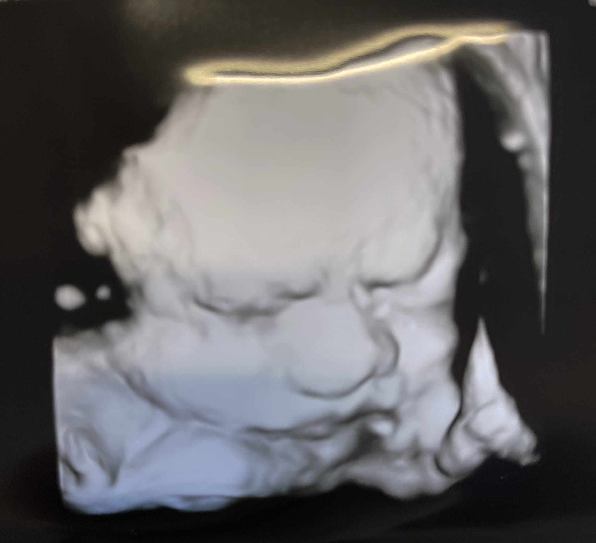 33 weeks
