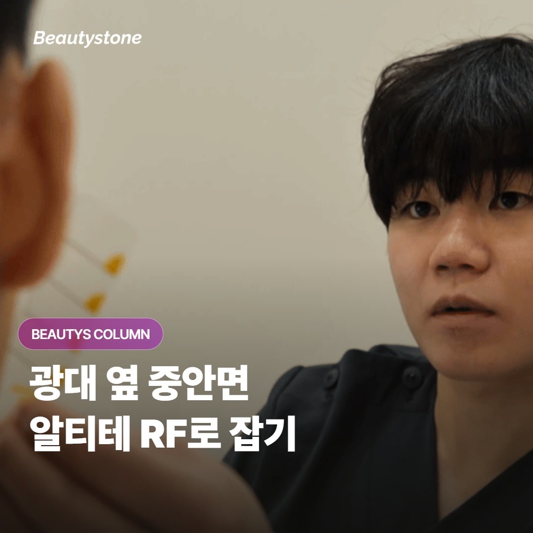 알티테 RF는 광대 옆으로 처지는 중안면 볼륨에 어떻게 작용하고 누구에게 잘 맞을까요?