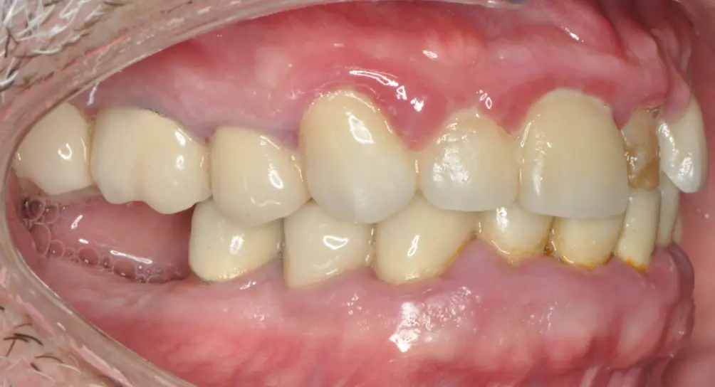 Before ortho treatment