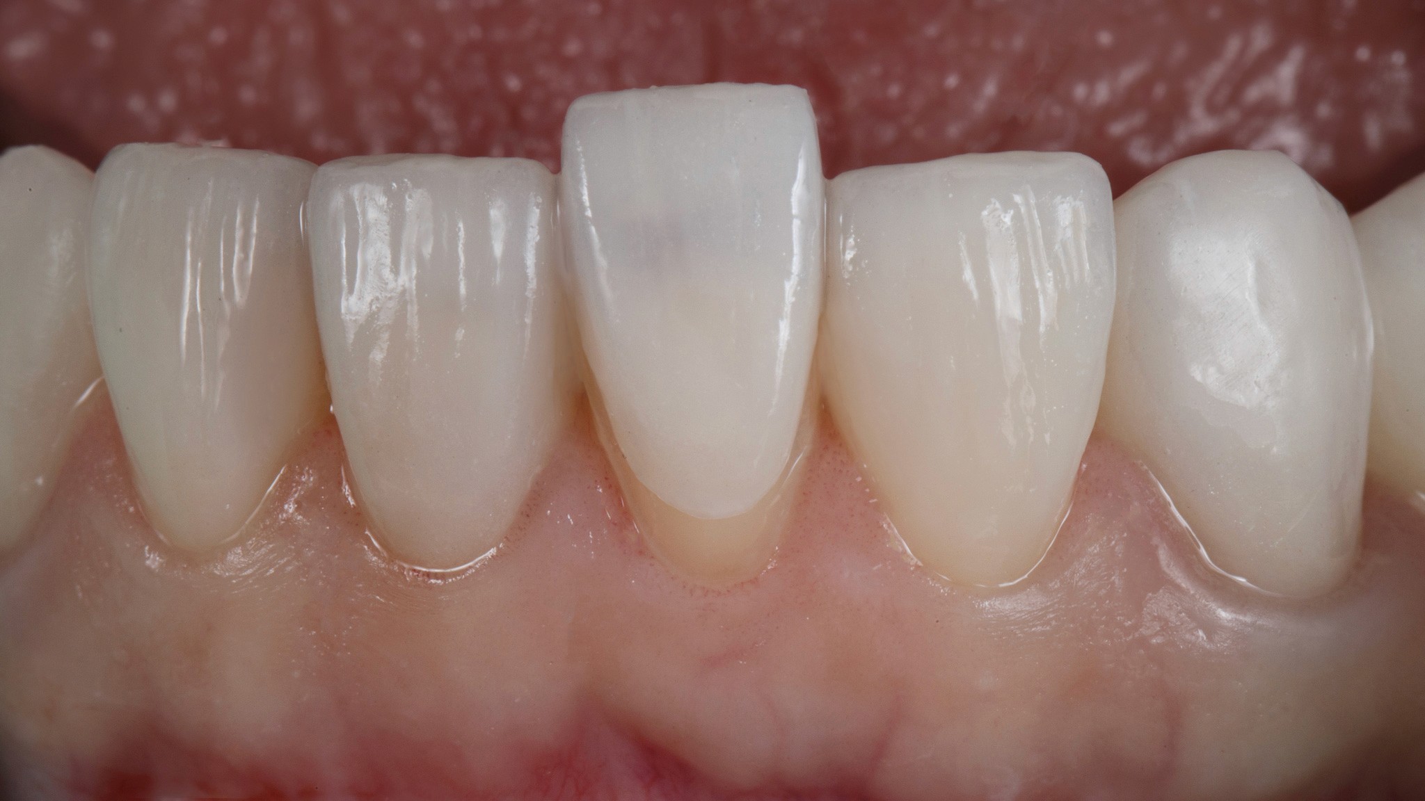 Praktijk voor Facings in Amsterdam Zuid