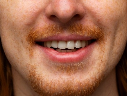 Ausência de Dentes: Consequências