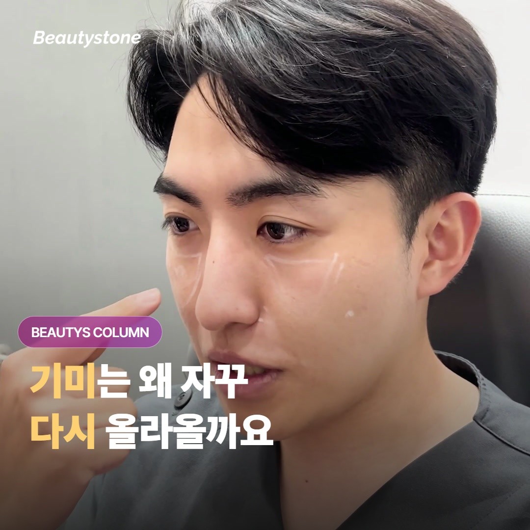 기미는 색소 레이저로 한 번에 없어지지 않고, 왜 자꾸 다시 올라오곤 하는 걸까요?