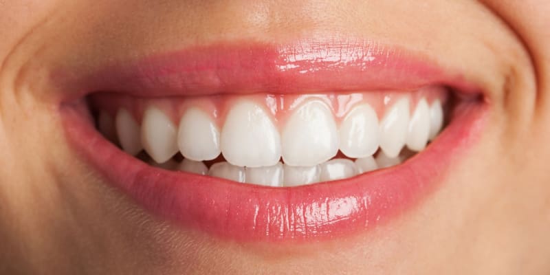 Зуби після відбілювання