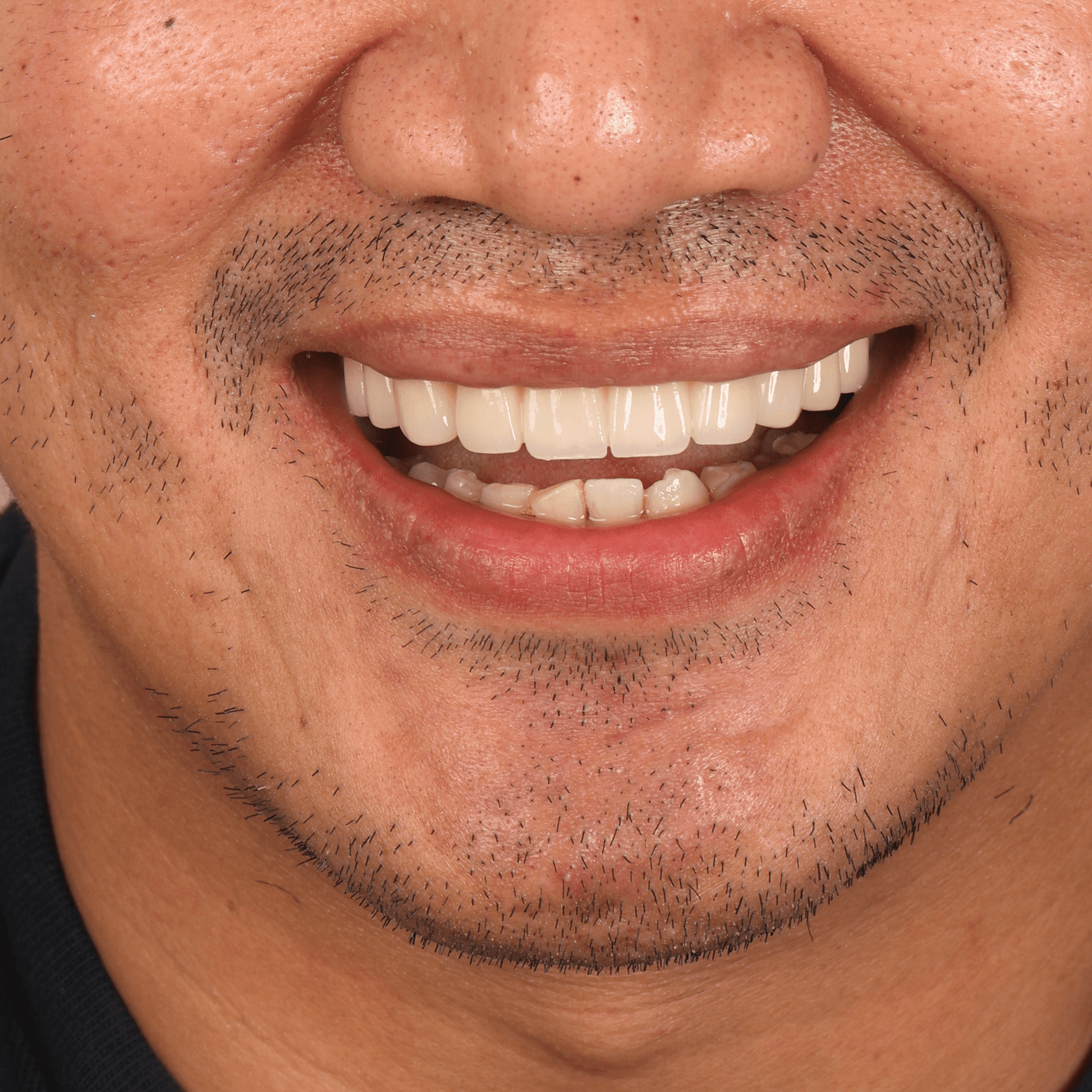 Healthy smile of a male patient representing endodontic care, root canal treatments, and dental X-ray services at Ora Dental.