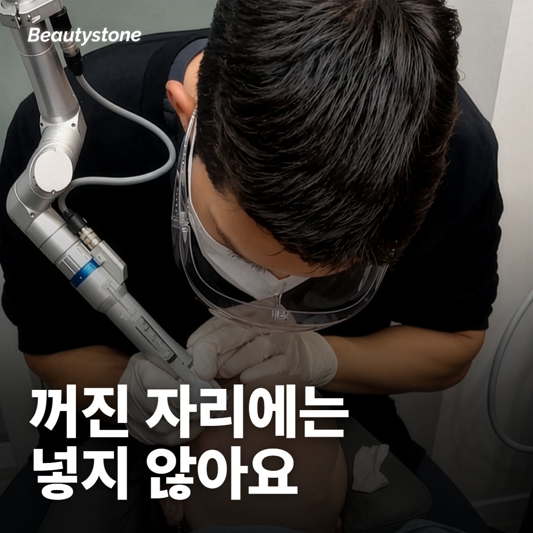 꺼진 얼굴에 울쎄라를 넣으면 더 꺼져 보일 수 있어요