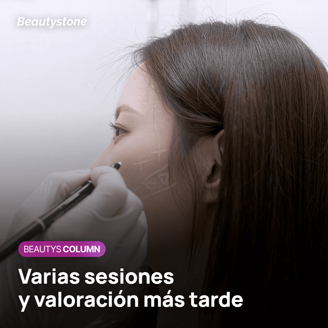 Sesiones de Juvelook Volume y momento de valorar el resultado