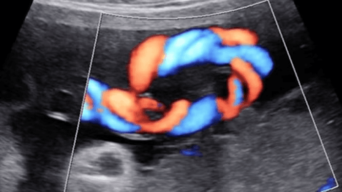 Imagem ilustrativa do exame