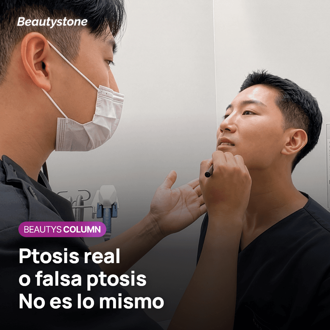 La ptosis verdadera y la ptosis falsa no son lo mismo