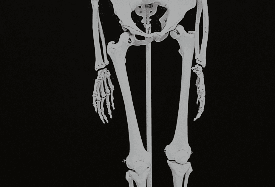 The image shows a complete human skeleton displayed against a black background. The skeleton is mounted on a vertical pole and is viewed from the front. The bones are white and appear detailed, with some joints and articulation points visible. The skeleton is positioned in a standing posture with the arms resting at the sides and the legs slightly apart. The image is in grayscale, highlighting the bone structure without any color or shading.
