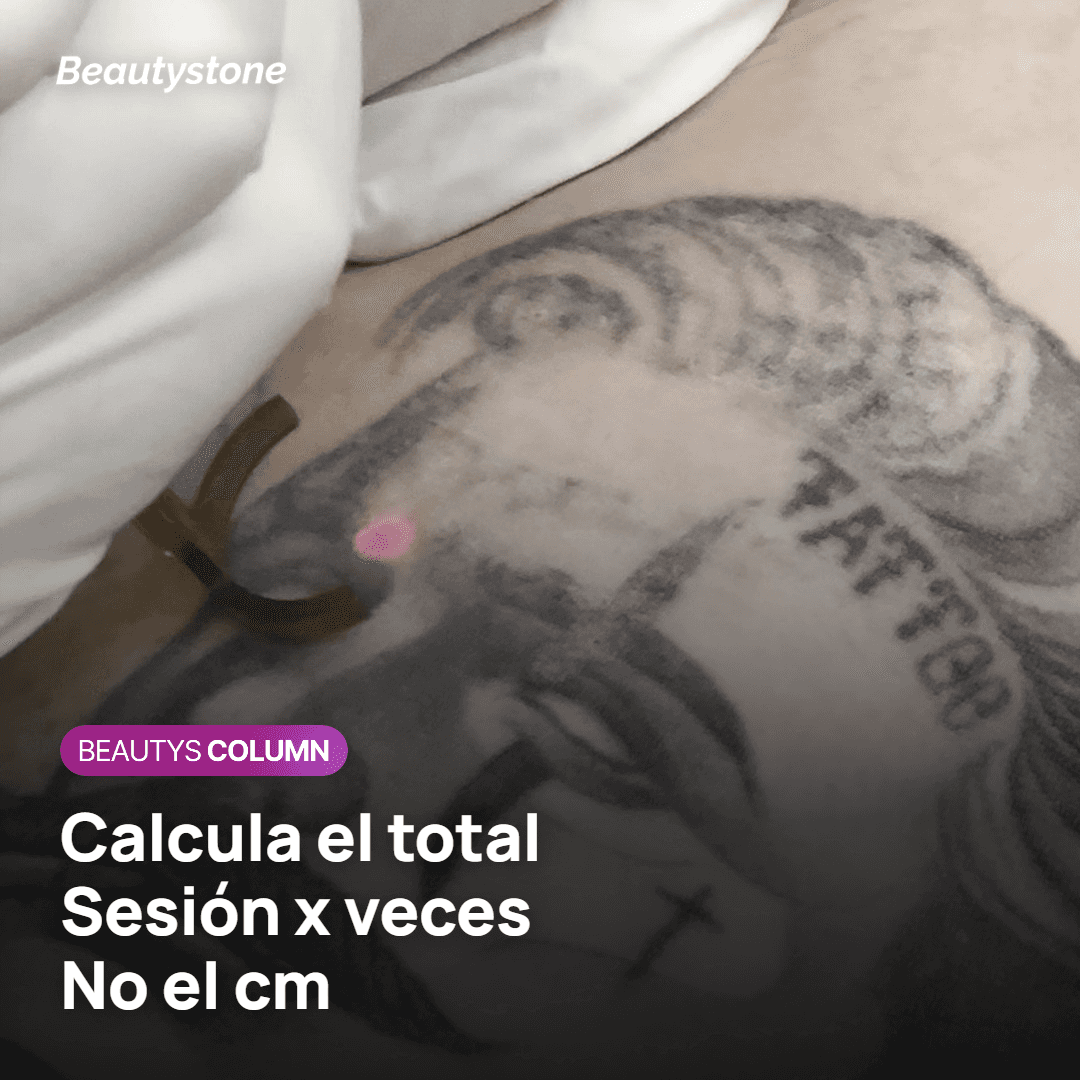 ¿Borrarlo cuesta diez veces lo que tatuarlo? Simulación del total