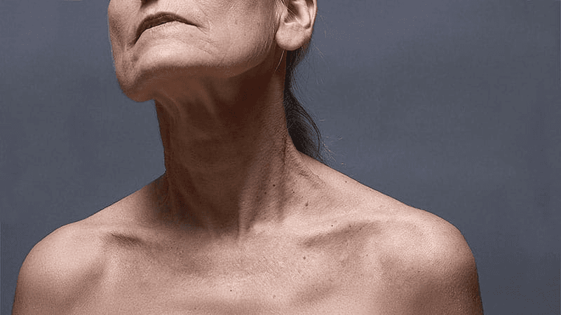 What Causes Chest and Décolletage Aging?
