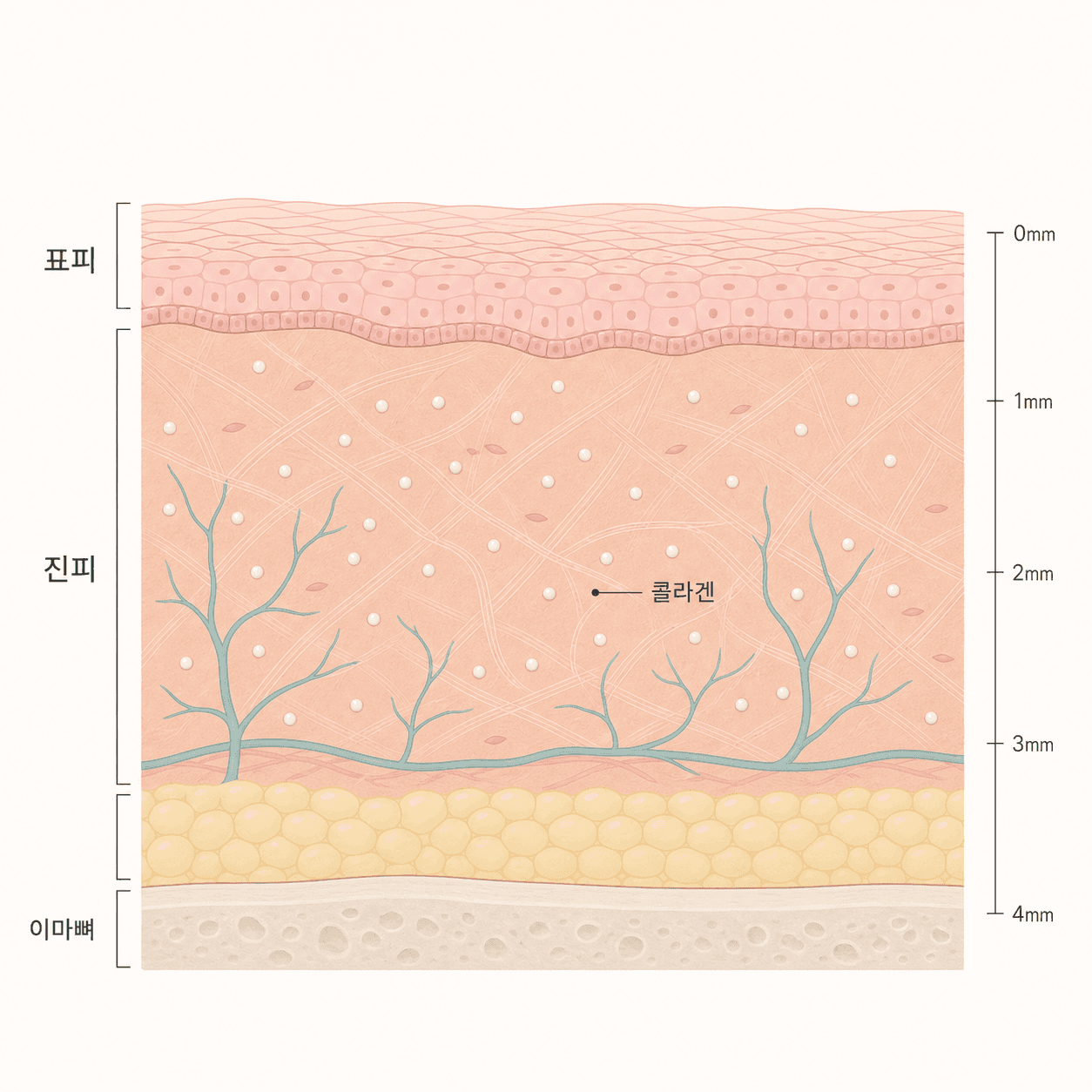 이마 진피에서 자극되어 채워지는 콜라겐 층