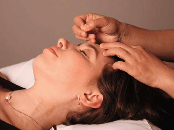 facial acupuncture for rejuvenation