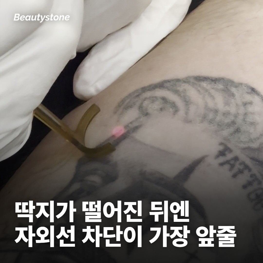 딱지가 붙어 있는 동안 — 손, 물, 마찰