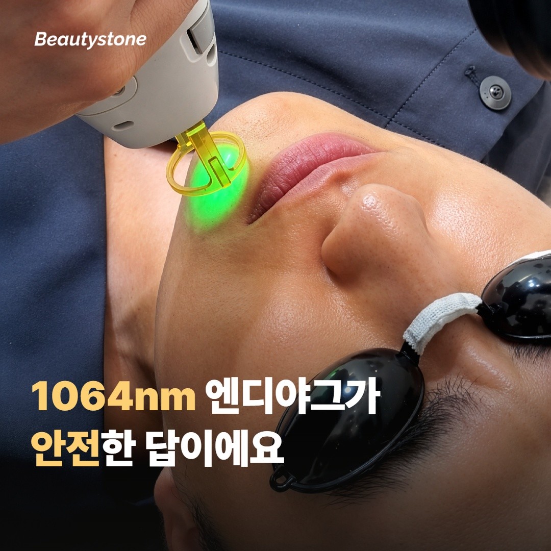 착색 있다면 파장이 답