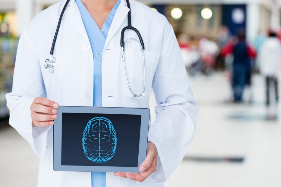 A doctor showing a human brains image.