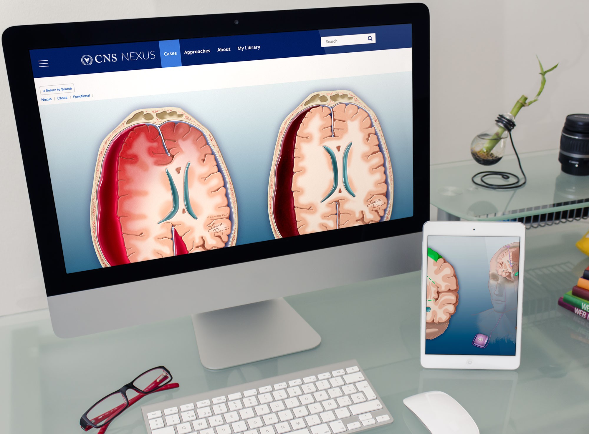 CNS: Neurosurgical Pathology