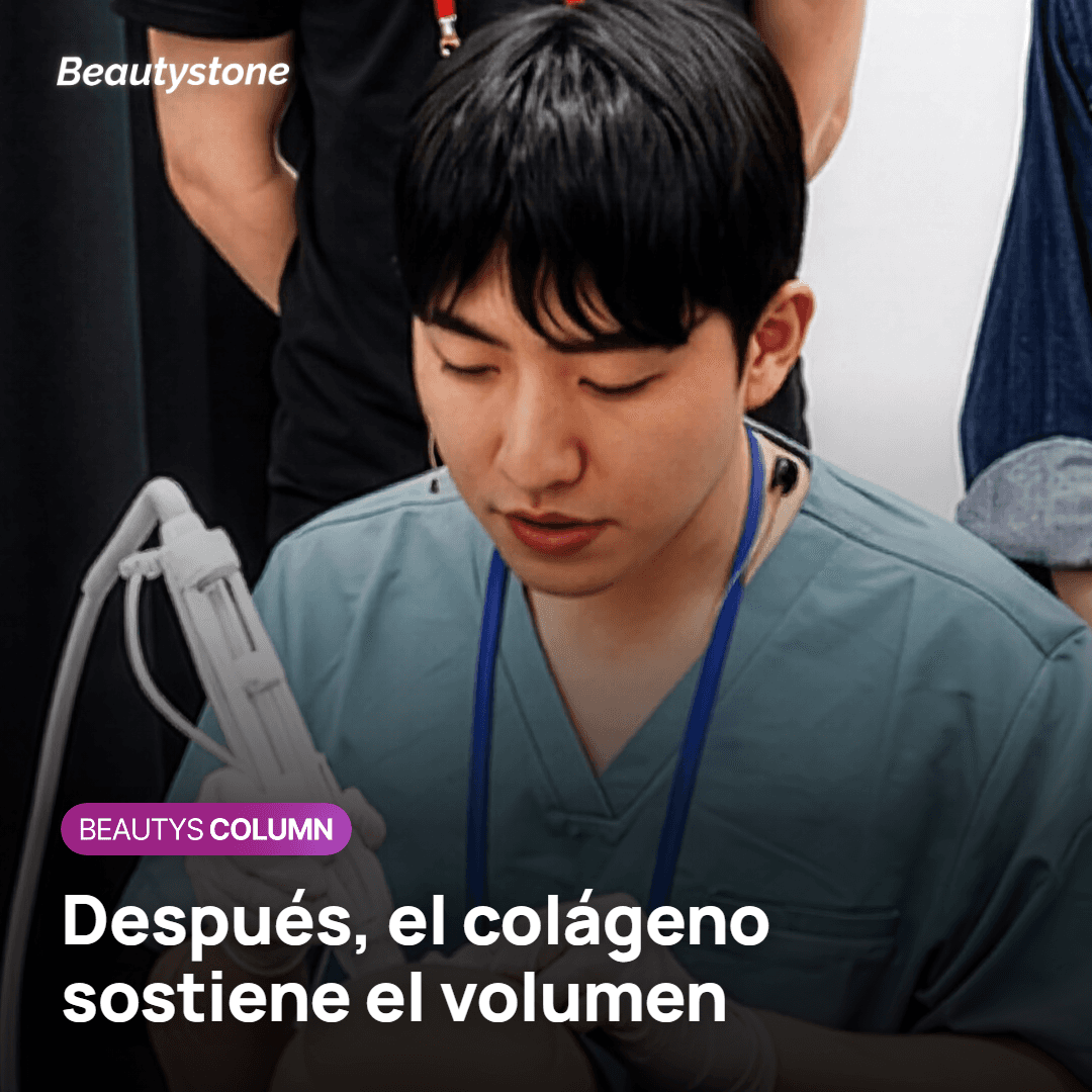 Colágeno estimulado por la CaHA que mantiene el volumen