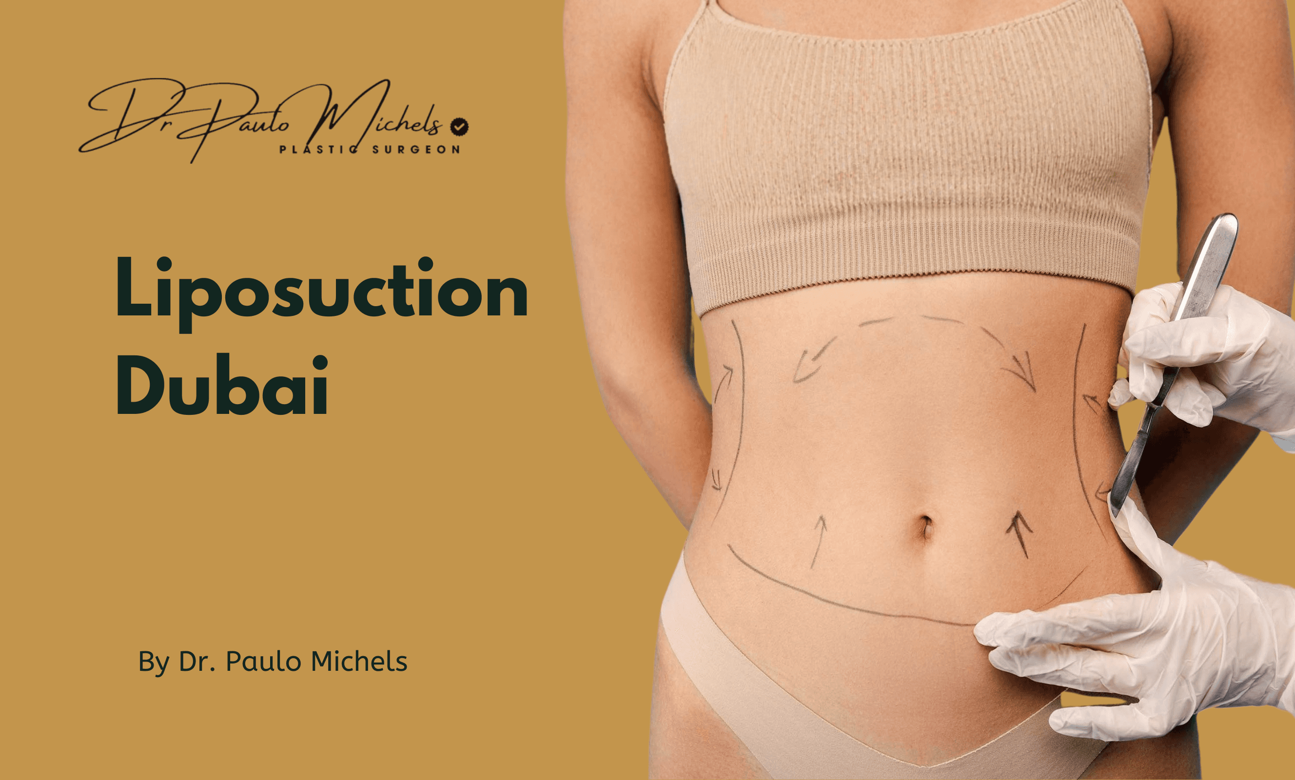 liposuction-in-dubai-what-to-expect-before-and-after