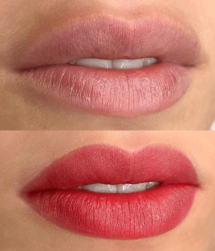 Crop view of lips, before and after the procedure