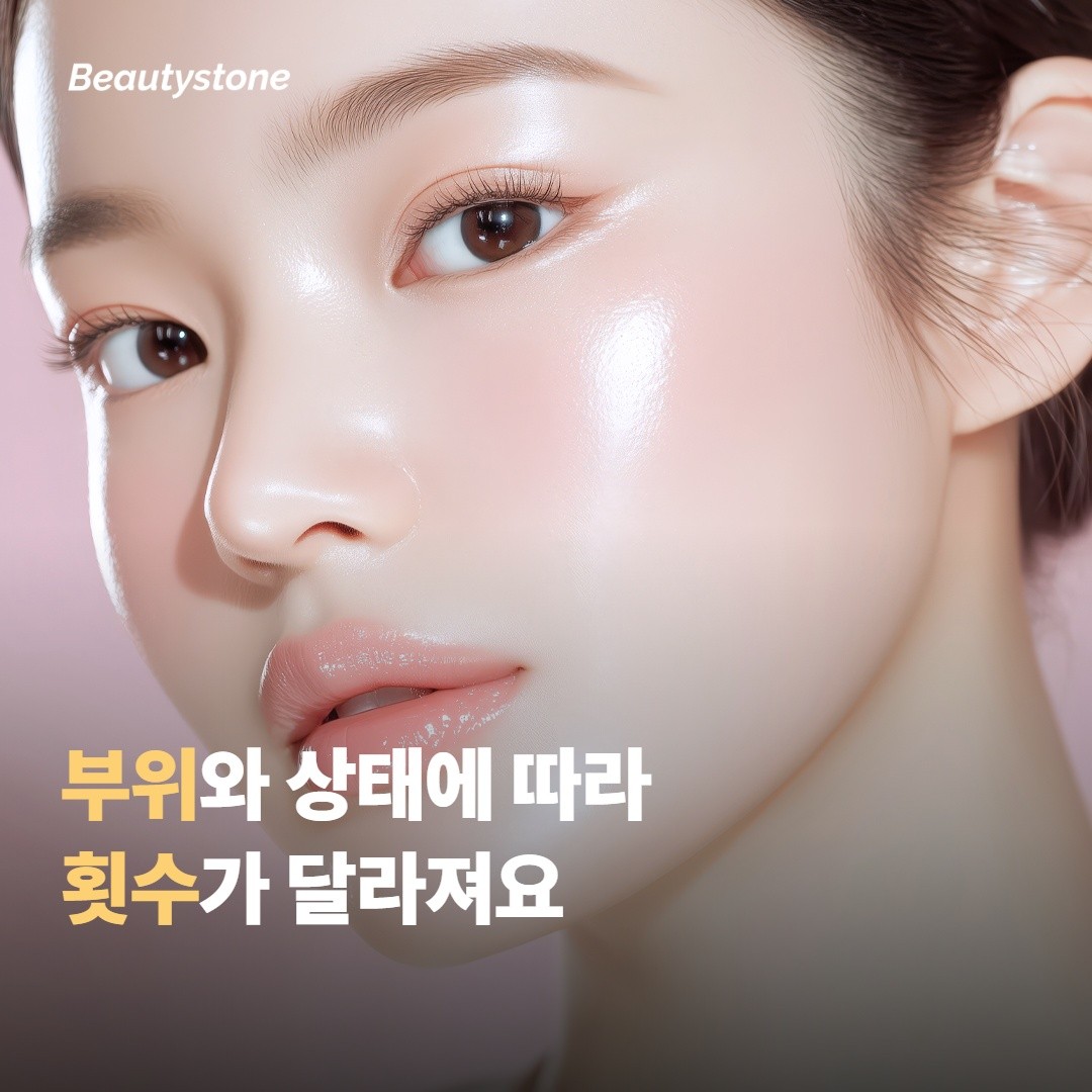 부위와 피부 상태에 따라 횟수가 달라지는 지점