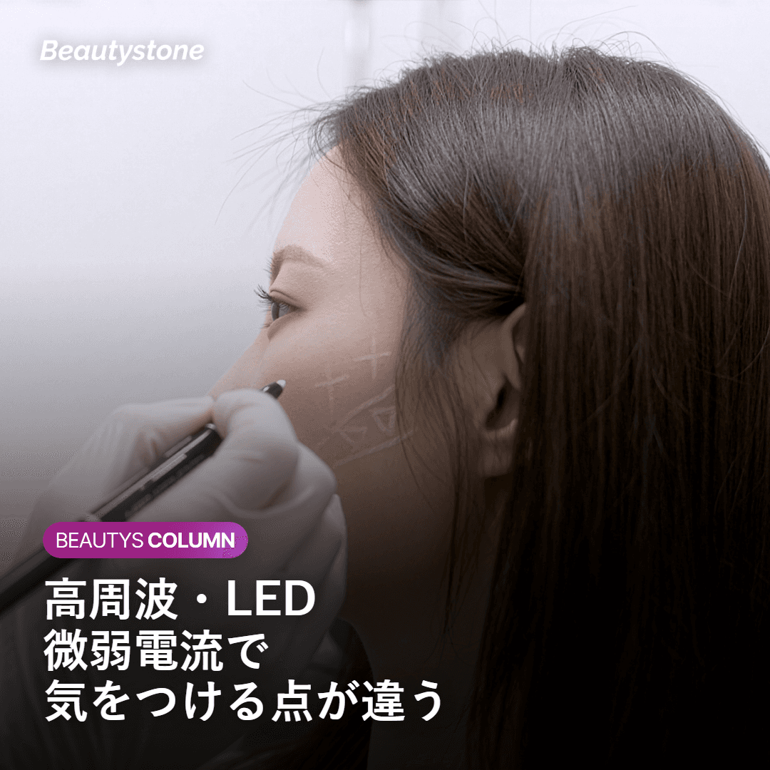 機器の種類ごとに確認したい点を示したイメージ画像