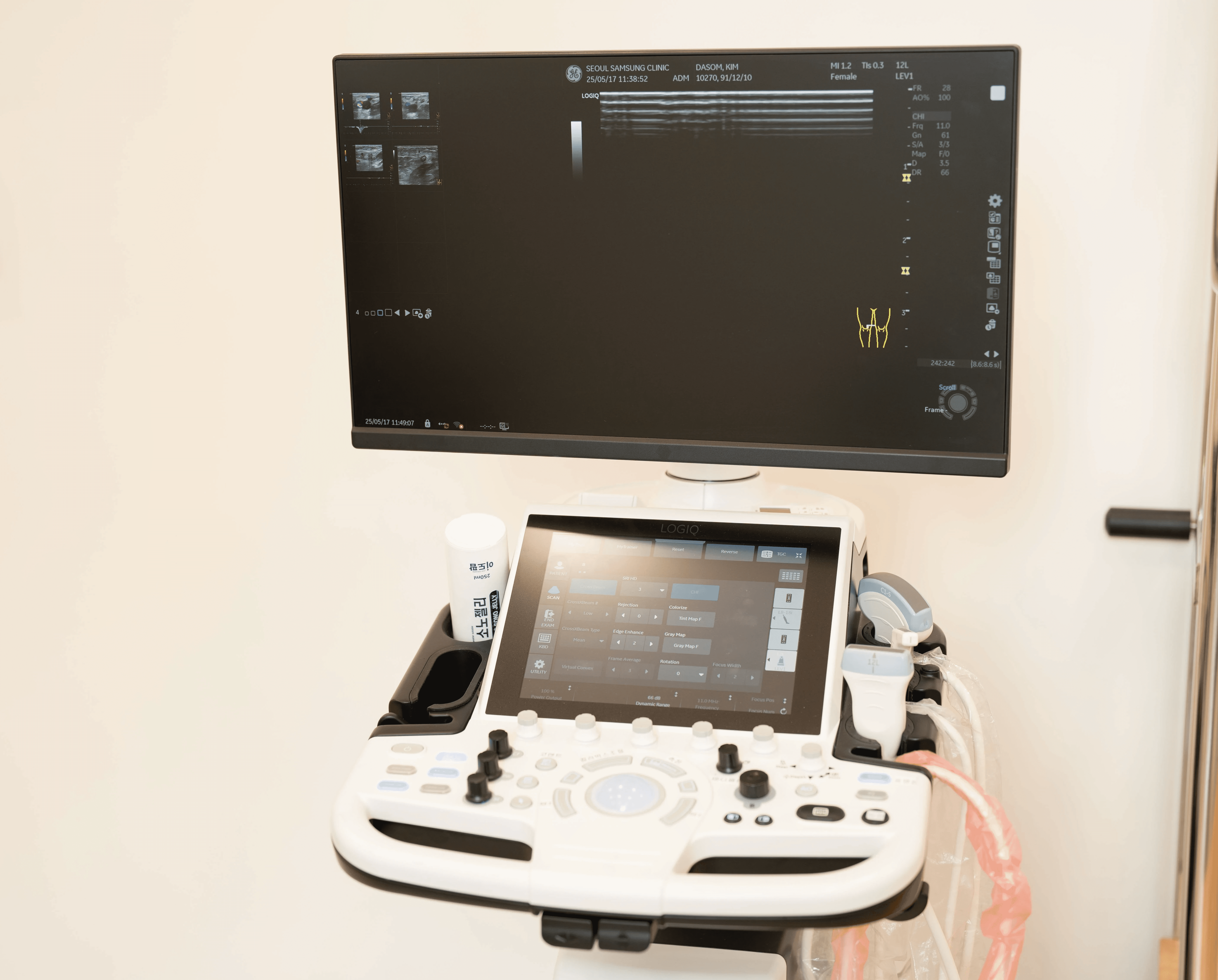 도플러 초음파 검사