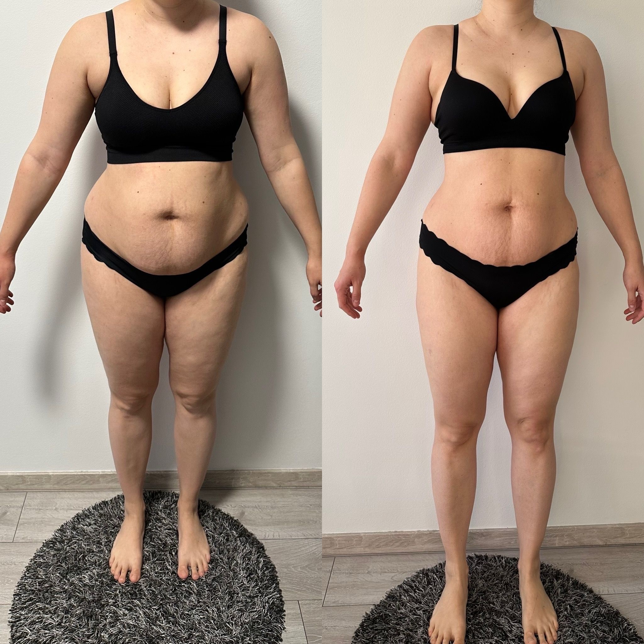 Transformation Photo