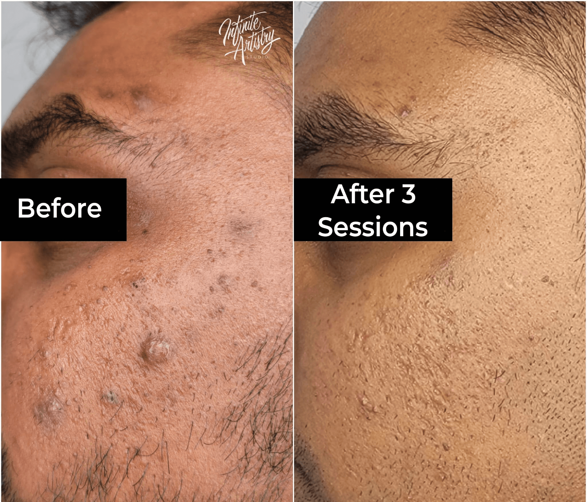 Another 1 Barbershop Beard Style