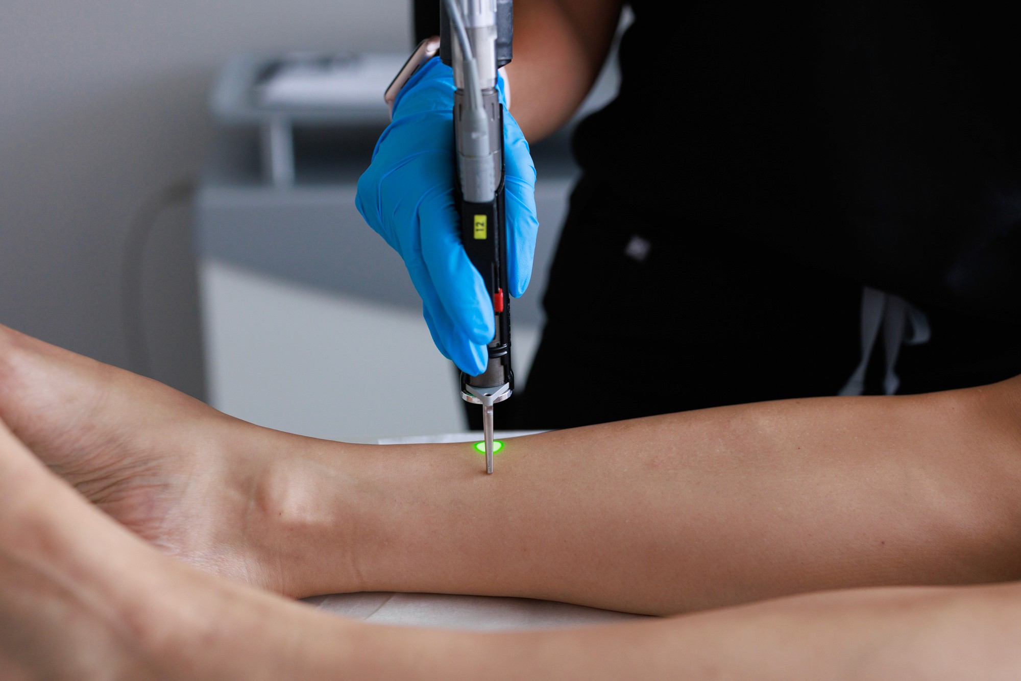 Beautician and a patient getting her legs laser hair removal