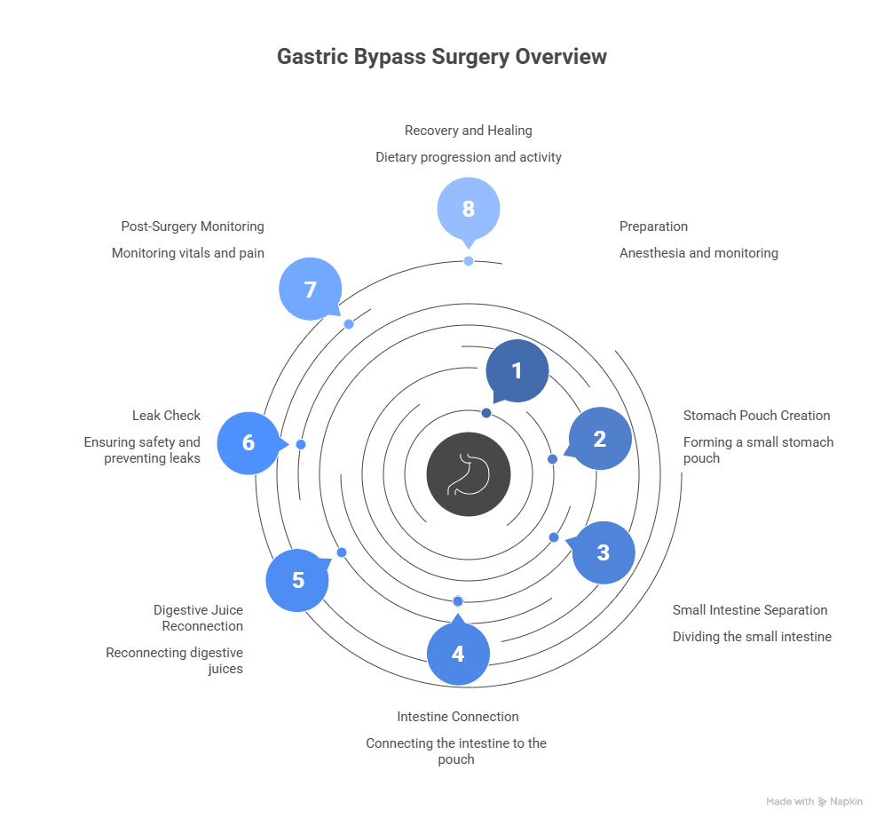 Gastric Bypass Surgery Overview