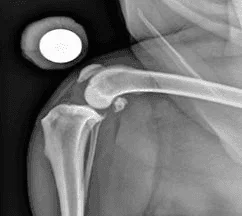 CT scan used in veterinary orthopedic surgery to plan a Cruciate Ligament Surgery (CCL/ACL).