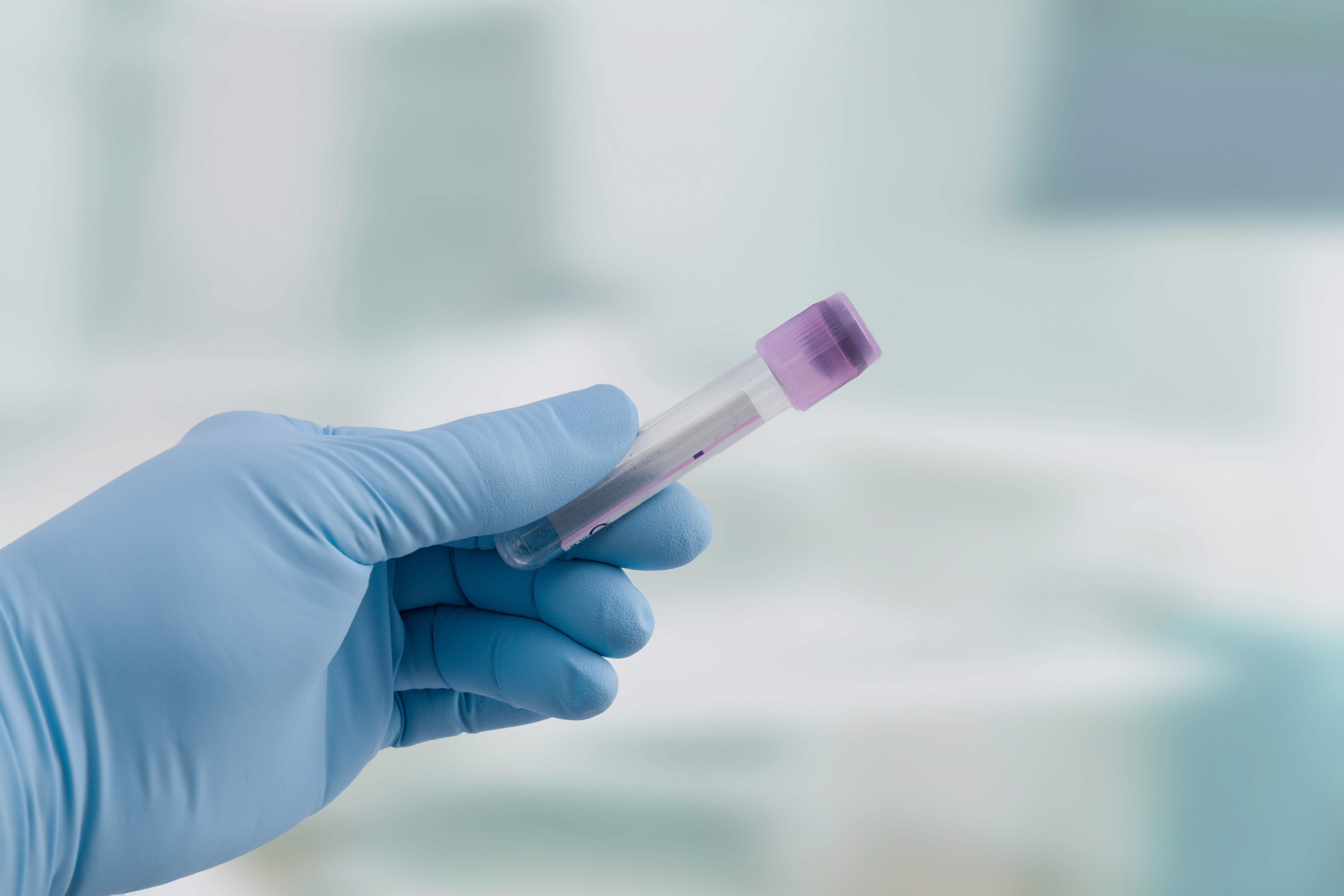 Hand with a blue latex glove holding a sealed tube.