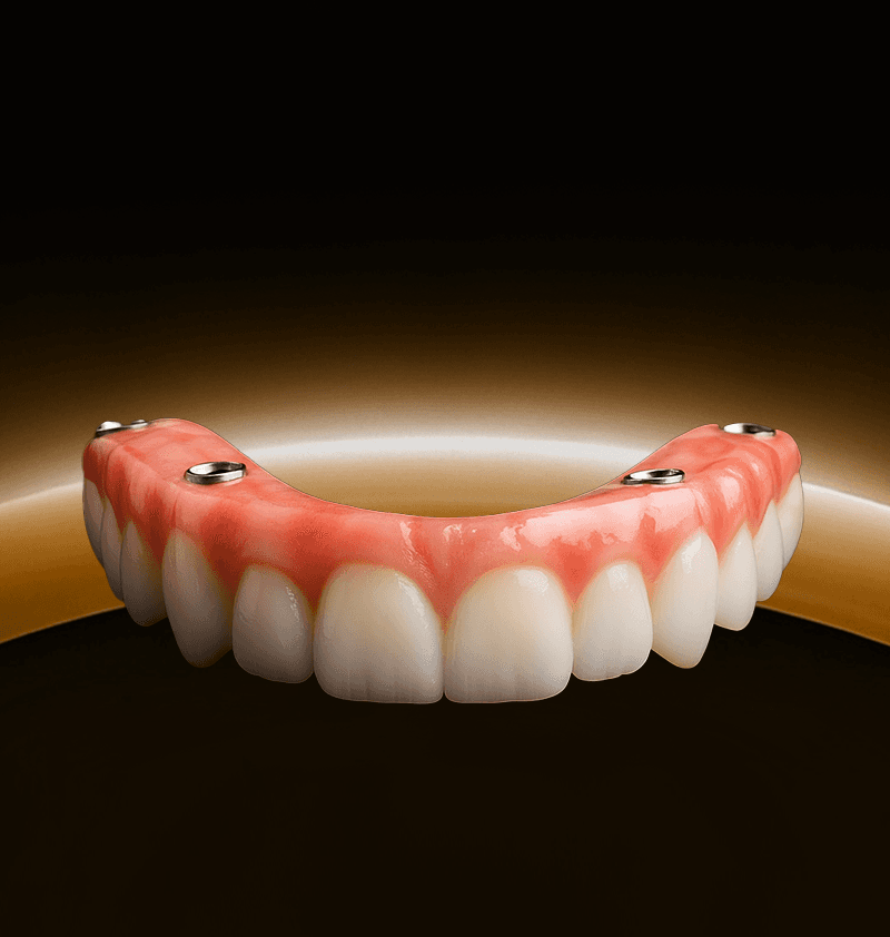 Digital Treatment Planning