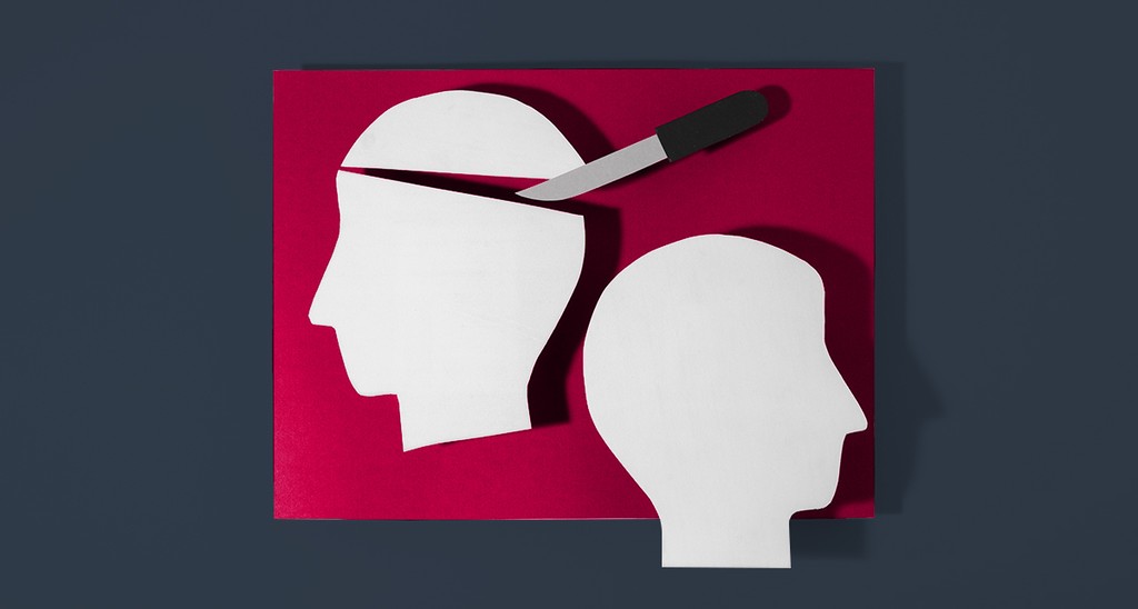 Internal Audit Vs External Audit What S The Difference