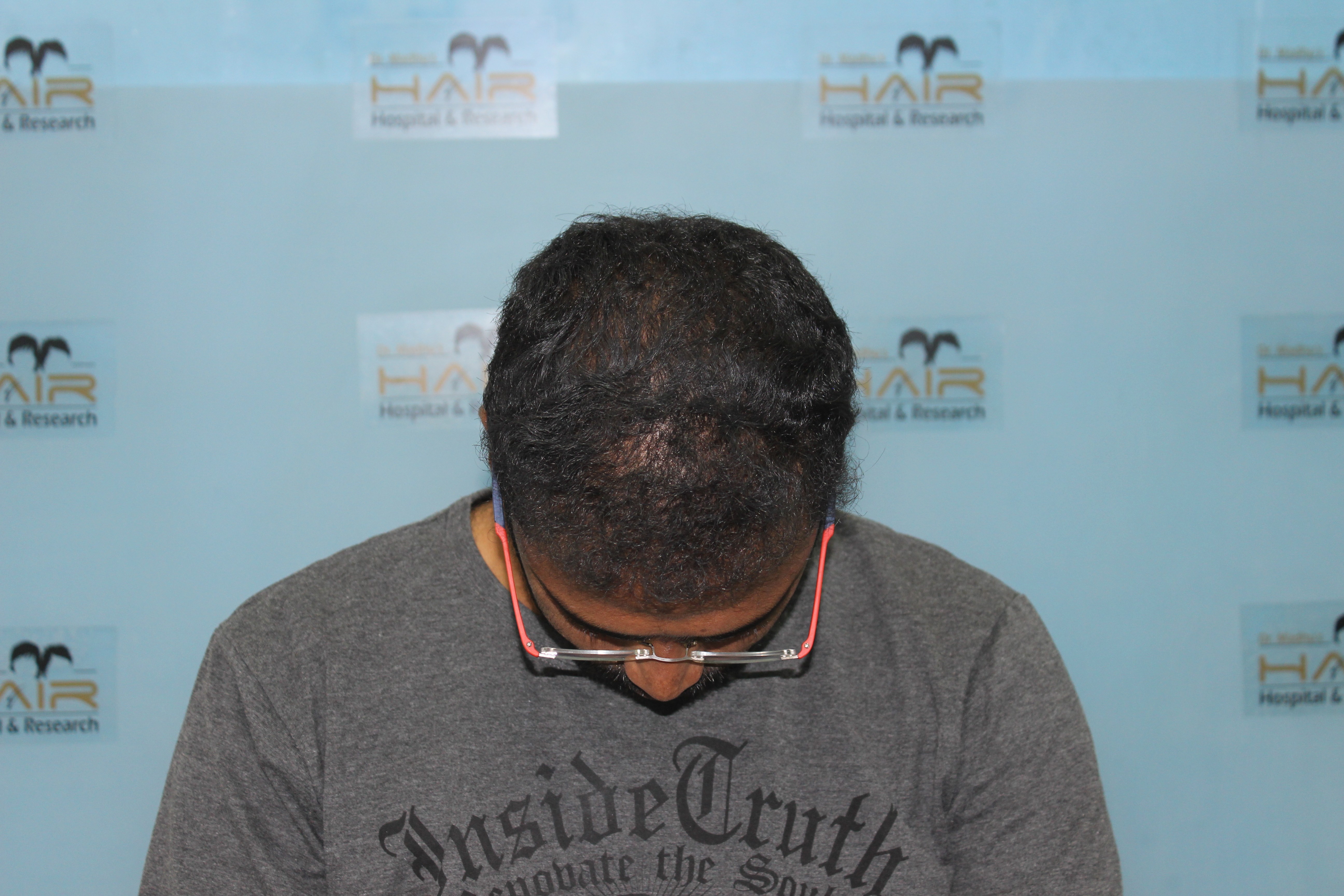 Close-up of mouth with glossy red-black lipstick and metallic teeth spelling 'BITE