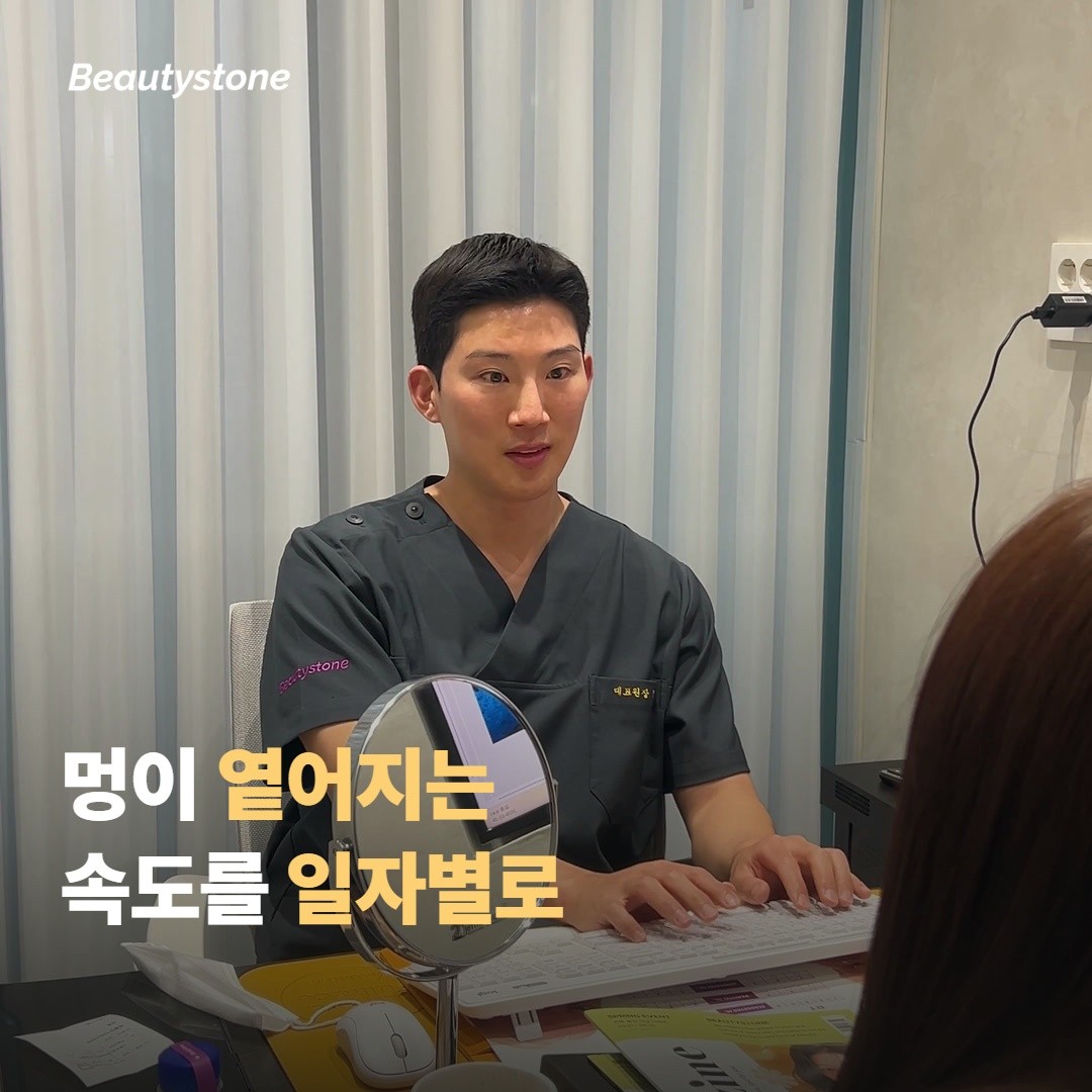 멍이 옅어지는 속도, 일자별로 보면 이래요